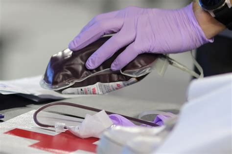 Fda Relaxes Blood Donation Guidelines For Men Who Have Sex With Men