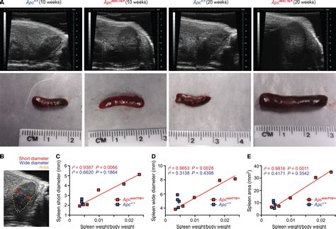 Ultrasound Imaging Of Splenomegaly As A Proxy To Monitor Colon Tumor