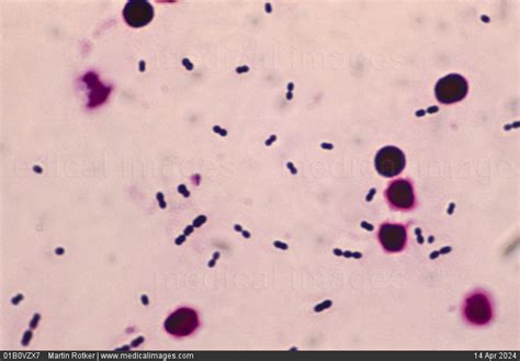Stock Image Photomicrograph Of Streptococcus Pneumoniae Also Called
