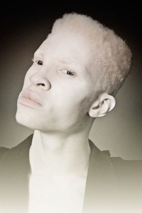 200 Best Albino Images Albino Albinism Albino Model