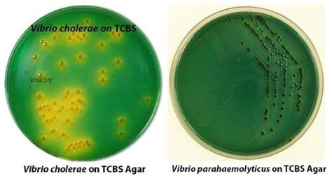 An Overview Of Key Pathogenic Vibrios Food Microbiology Academy