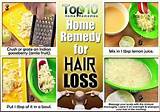 Female Baldness Home Remedies
