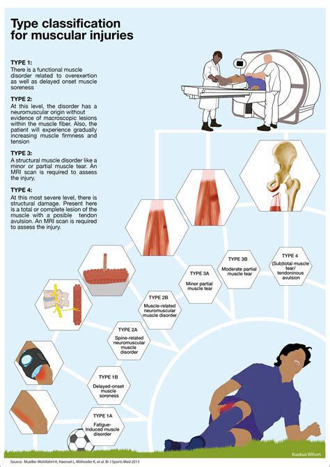 Infographics The South African Sports Medicine Association SASMA