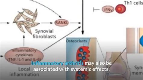 Inflammatory Polyarthritis Vs Rheumatoid Arthritis Youtube