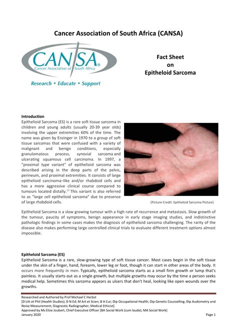 pdf cancer association of south africa cansa fact sheet on epitheloid sarcoma