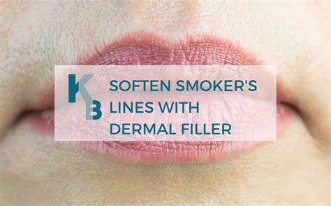 Treatment For Smokers Lines With Dermal Filler