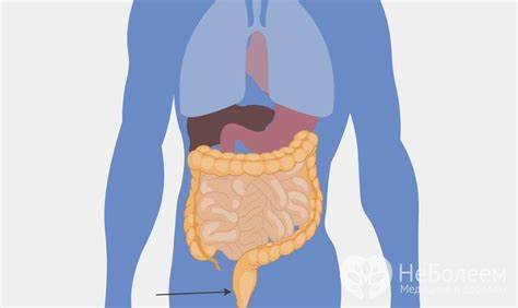 Сигмовидная кишка лечение диета Прямая кишка - лечение, строение, функции Прямая кишка - лечение, строение, функции Сигмовидная кишка лечение диета