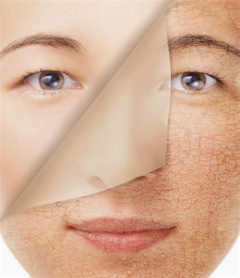 What Are The Best Treatment Options For Sun Damaged Skin Sandel Duggal
