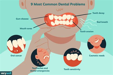 The 9 Most Common Dental Problems