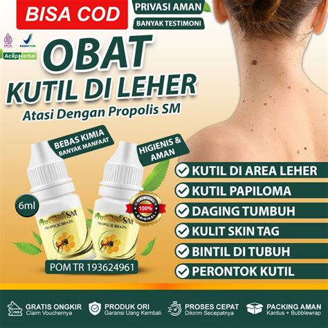 Jual Obat Papiloma Di Leher Penghilang Kutil Papiloma Di Wajah Kutil Di