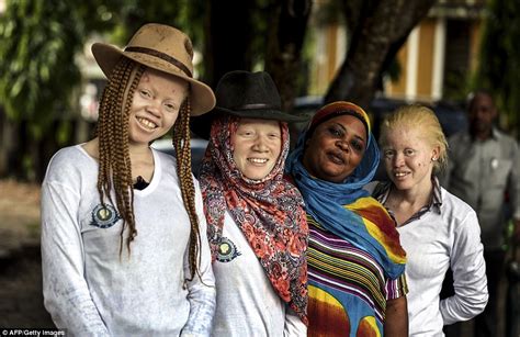 tanzania albino girl among hundreds seeking refuge from murderous witch doctors daily mail online
