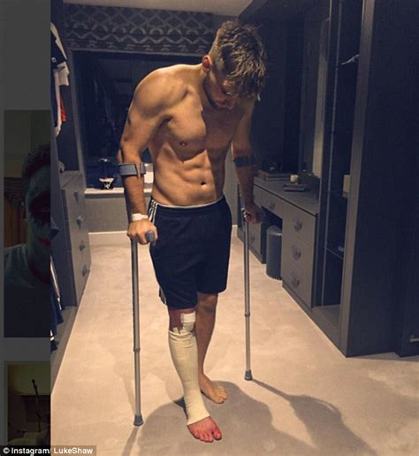 Manchester united's luke shaw says he nearly lost his leg after breaking it in two places in september 2015. Luke Shaw off his crutches at Manchester United Christmas party... less than two months after ...