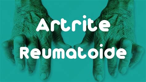 CONHEÇA MAIS SOBRE A ARTRITE REUMATOIDE Reumatocare YouTube