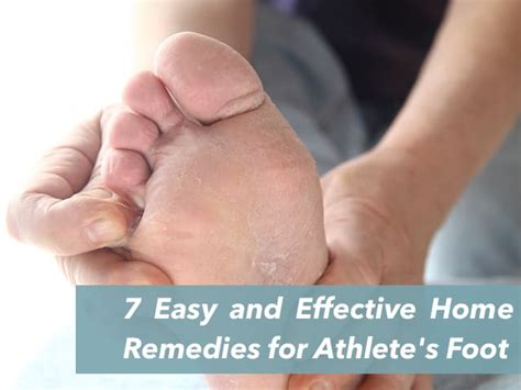 7 Easy And Effective Home Remedies For Athletes Foot Remedygrove