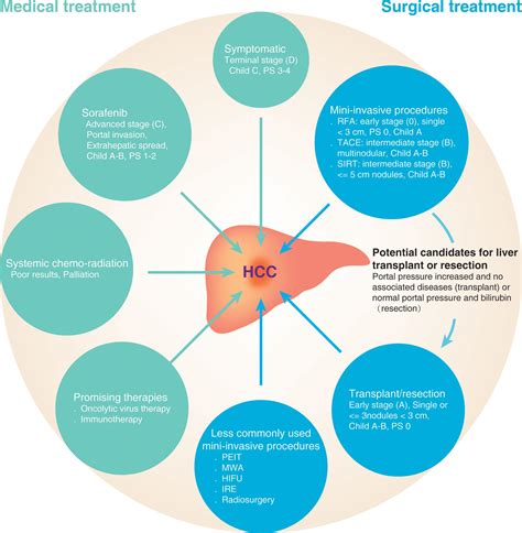 Current And Future Treatment Of Hepatocellular Carcinoma An Updated