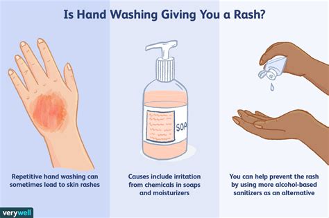 Allergic Reactions To Hand Washing