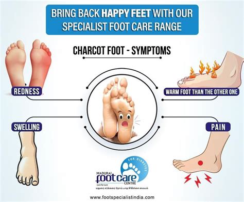 What Are The Causessymptoms And Treatments Of Charcot Foot Feet Care Doctor Help Care