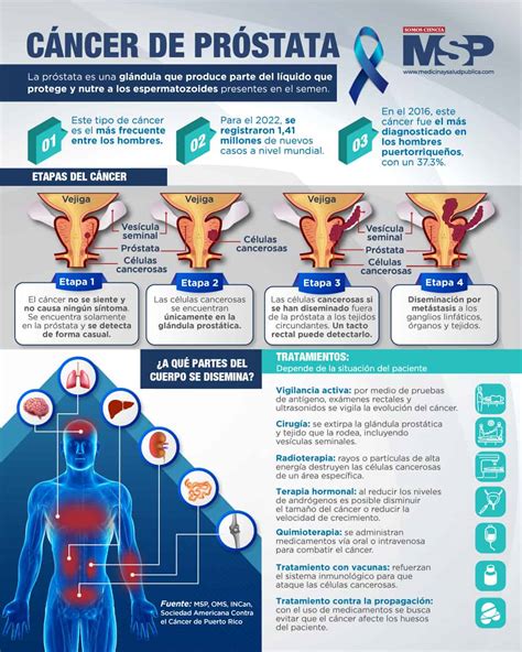 Cancer De Prostata Infograf A
