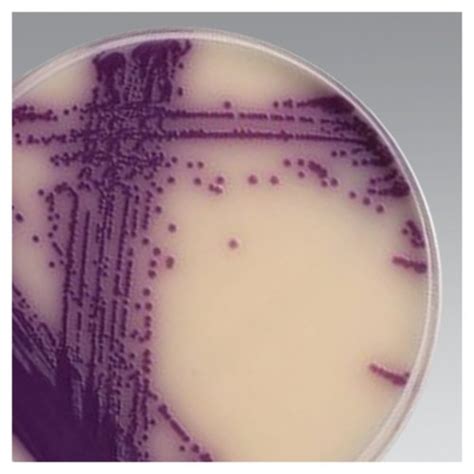 Brilliance Salmonella Agar Base 500g Labmal