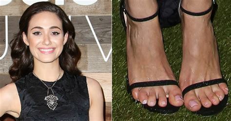 17 Ugly Celebrity Feet With Corns And Jacked Up Hammer Toes