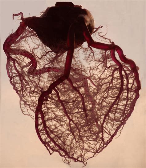 Start studying embryology of the heart. Anatomical Heart | This is the vasculature of an actual ...