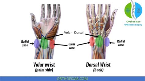 Wrist Pain Causes • Easily Explained Orthofixar 2023