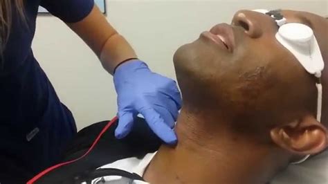 Laser Hair Removal In San Diego For Black Skin Youtube