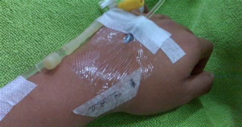 Jun 06, 2021 · infus immune booster dibagikan secara gratis di seluruh cabang ms glow aesthetic clinic di medan, malang, surabaya, sidoarjo, bandung, bekasi dan bali. Gambar Tangan Wanita Di Infus - Soft Educaiton