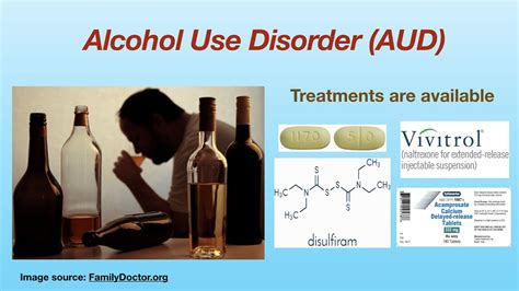 Treatments For Alcohol Use Disorder Aud Youtube