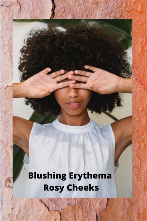 Blushing Erythema Rosy Cheeks Fear Erythrophobia Can It Stop Skin