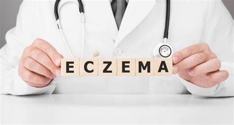 The Rise Of Eczema Causes Symptoms And Treatments 2ser