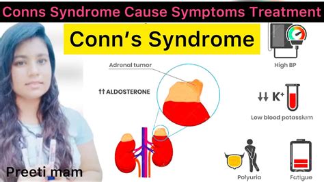 Conns Syndrome Cause Symptoms Diagnose Treatment In Hindi What Is