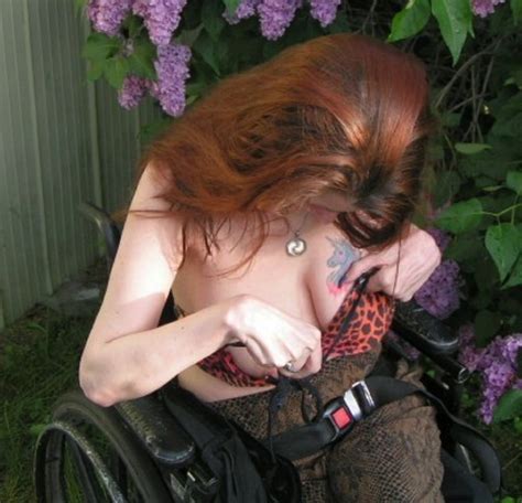 Paraplegic Whore Rose 28 Pics Xhamster