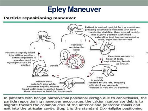 Epley Maneuver Instructions Spanish