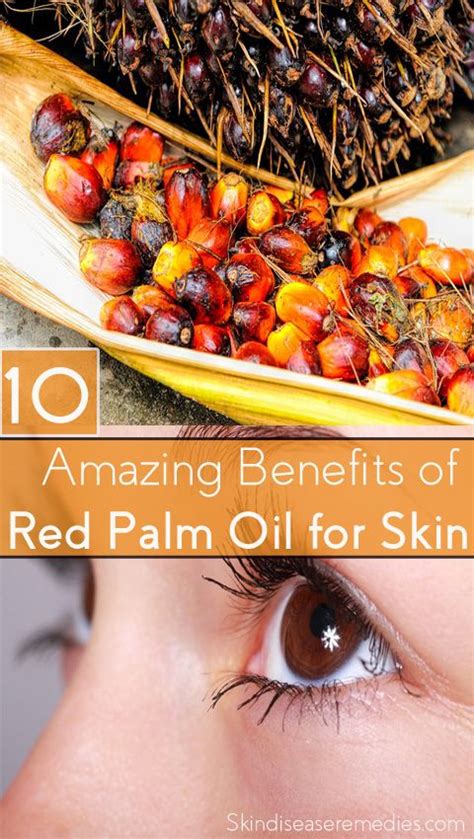 Red palm oil benefits for skin and hair include enhancing moisture retention and supplying nourishing antioxidants such as vitamin e, carotenes and more. Benefits of Palm Oil for Skin and Hair - (Skin Lightening ...