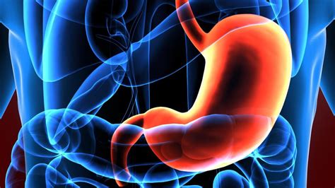 • the outlet of the stomach (the pylorus and duodenum) may be obstructed by an ulcer or tumor, or by something large and indigestible that was swallowed. The Signs and Symptoms of Gastric Cancer - HowStuffWorks