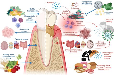 Frontiers Periodontal Disease The Good The Bad And The Unknown