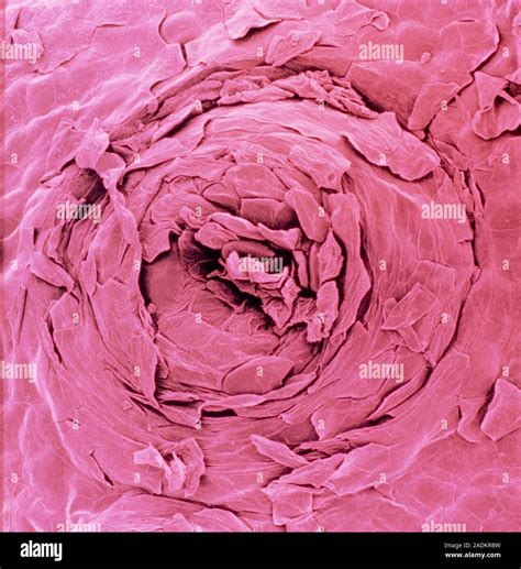 False Colour Scanning Electron Micrograph Of A Sweat Pore On The Human