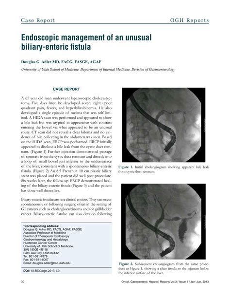 Pdf Endoscopic Management Of An Unusual Biliary Enteric Fistula