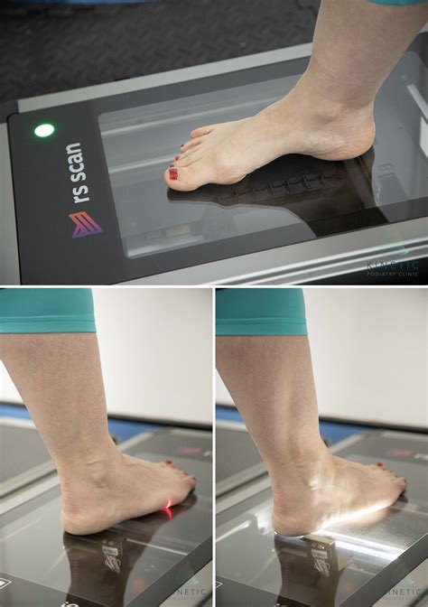 3d Foot Scan — Kinetic Podiatry