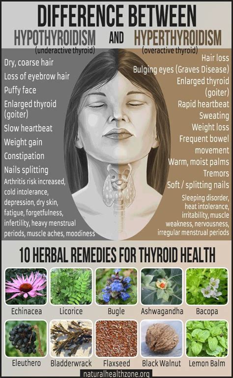 5 Essential Steps For Hypothyroidism Treatment Success Overactive