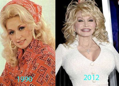 dolly parton plastic surgery dolly parton plastic surgery breast increase eyelid you
