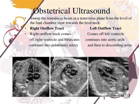 Pin By Gini Mosley On Sonography In 2021 Ultrasound Ultrasound