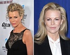 Kim Basinger Facelift Plastic Surgery Before and After | Celebie