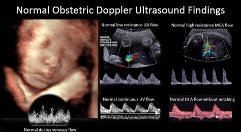 Ultrasonography Vs Ultrasound