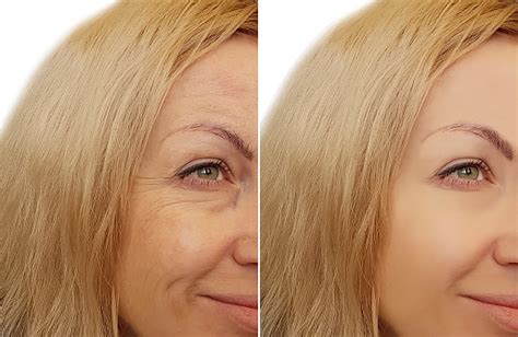 Woman Face Wrinkles Before And After Stock Photo Download Image Now