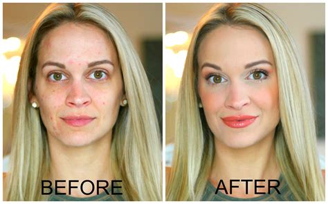 How To Cover Acne And Redness Full Coverage Makeup Routine Acne