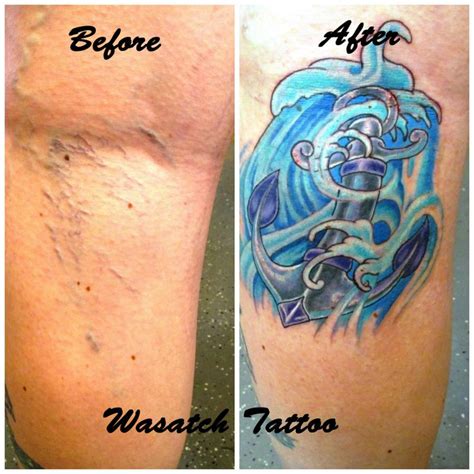 The usual criteria are that there are some symptoms that are typical of varicose veins (discomfort, swelling, fatigue, restlessness, aching and others). Varicose vein cover up tattoo by Lacey Megeath at Wasatch ...