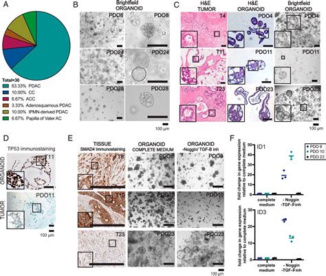 Pancreatic Cancer Organoids Recapitulate Disease And Allow Personalized