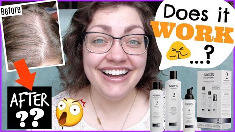 If the hair texture is baby fine, stick. GOING BALD!? | 6 Months Using NIOXIN For Noticeably ...